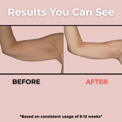 Red Light Therapy Band